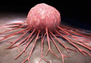 غافل از سرطان