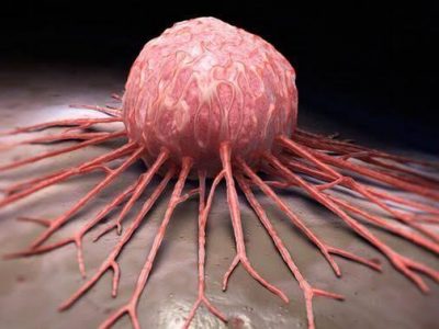 غافل از سرطان